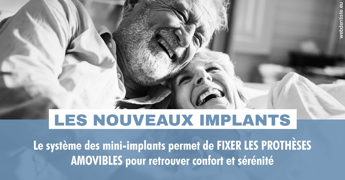 https://www.dr-hivelin-orvault.fr/Les nouveaux implants 2