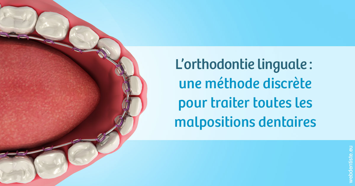 https://www.dr-hivelin-orvault.fr/L'orthodontie linguale 1