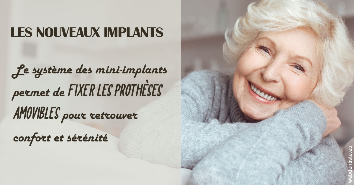 https://www.dr-hivelin-orvault.fr/Les nouveaux implants 1