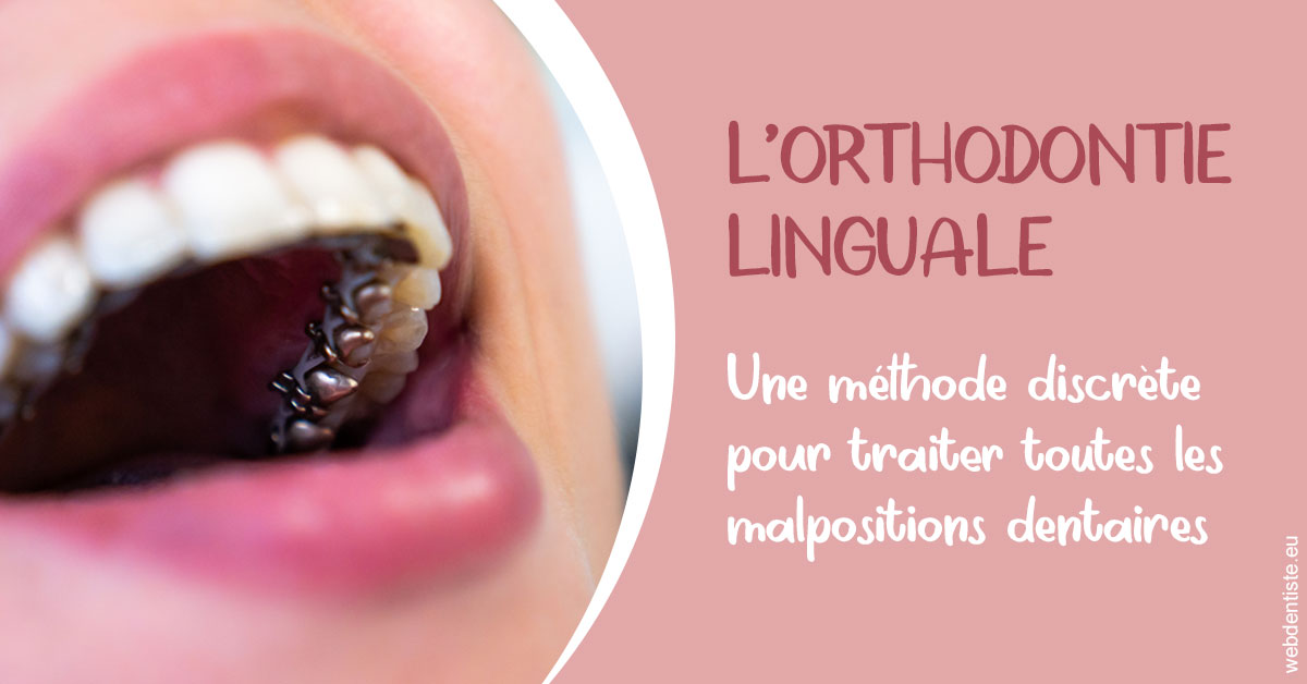 https://www.dr-hivelin-orvault.fr/L'orthodontie linguale 2
