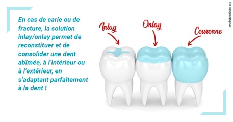 https://www.dr-hivelin-orvault.fr/L'INLAY ou l'ONLAY