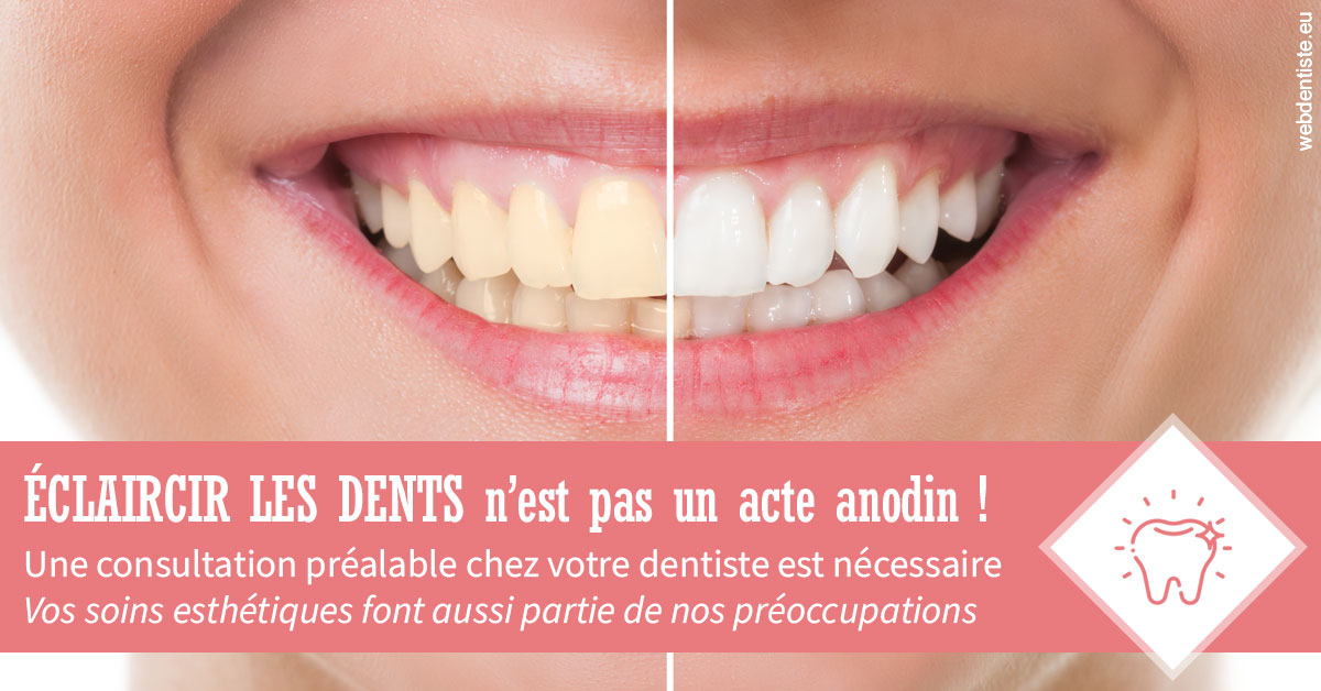 https://www.dr-hivelin-orvault.fr/Eclaircir les dents 1