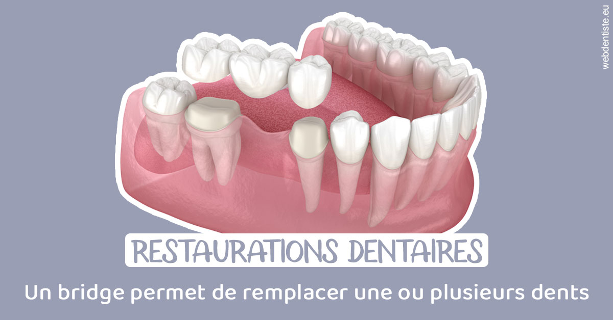 https://www.dr-hivelin-orvault.fr/Bridge remplacer dents 1
