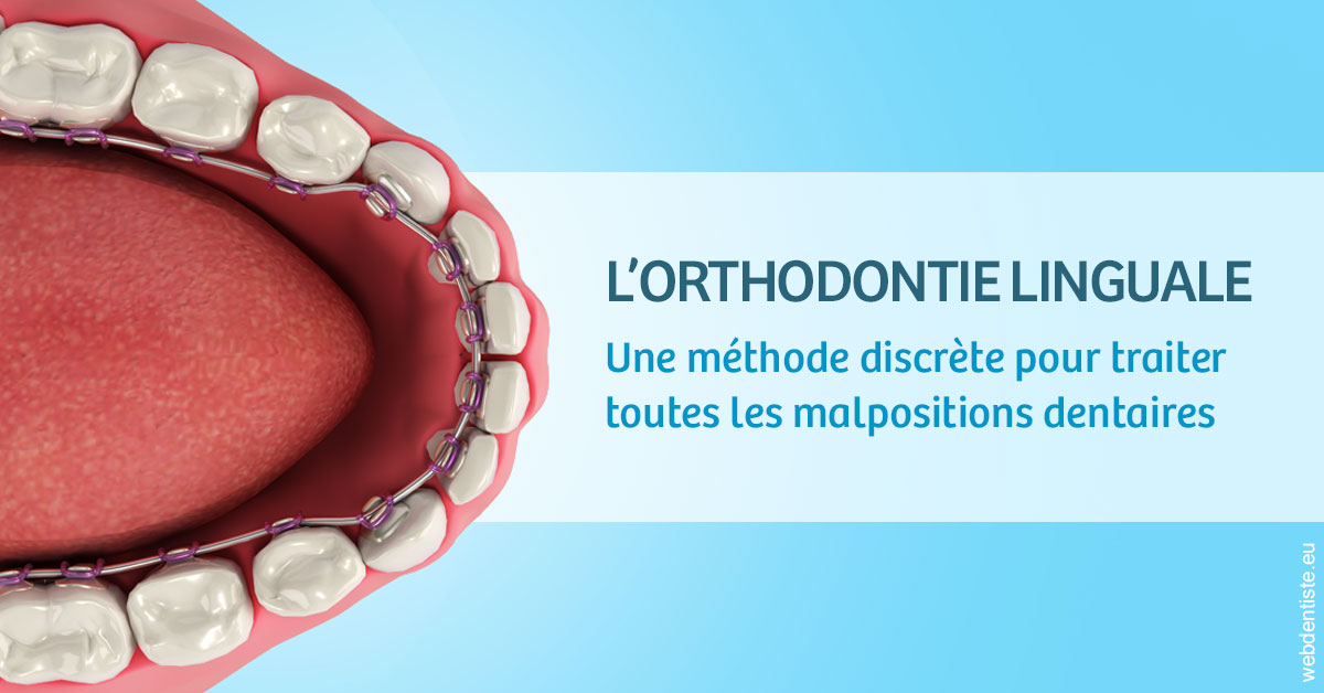https://www.dr-hivelin-orvault.fr/L'orthodontie linguale 1