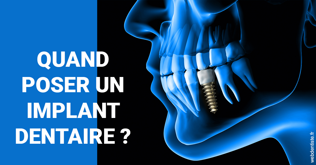https://www.dr-hivelin-orvault.fr/Les implants 1