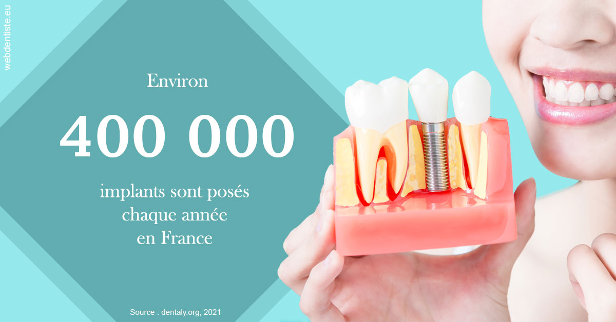 https://www.dr-hivelin-orvault.fr/Pose d'implants en France 2