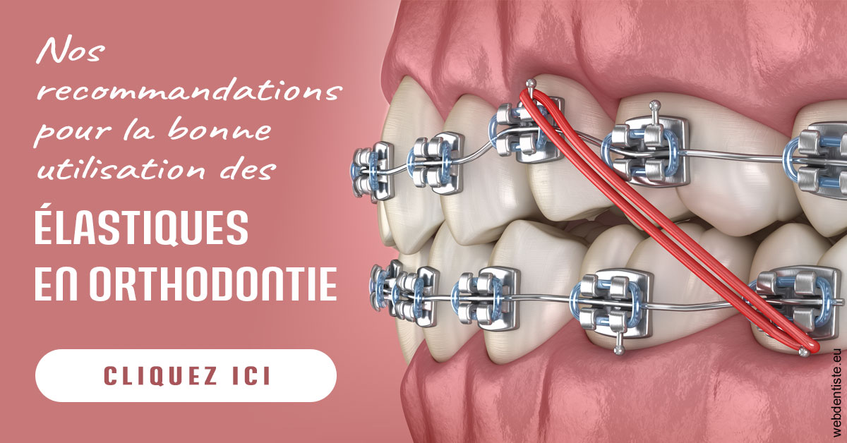 https://www.dr-hivelin-orvault.fr/Elastiques orthodontie 2